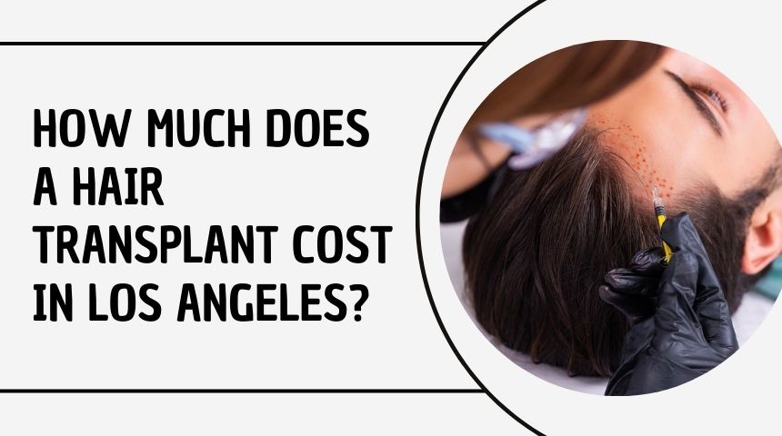 How Much Does a Hair Transplant Cost in Los Angeles?